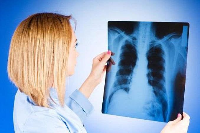 В трех учебных заведениях Одесской области обнаружили туберкулез