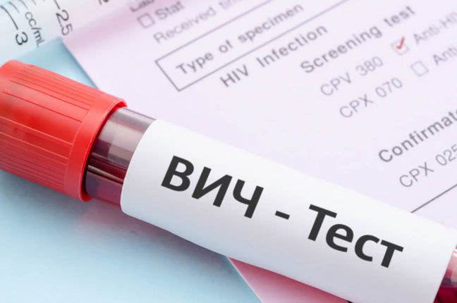 718 ВИЧ-инфицированных выявили в Одессе в прошлом году