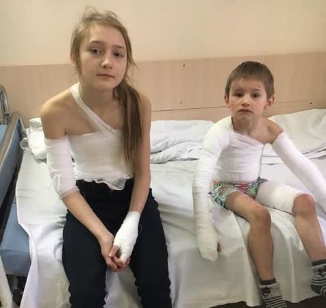 Нужна помощь: в Одесской области ребенок опрокинул на себя бидон с кипятком (фото)
