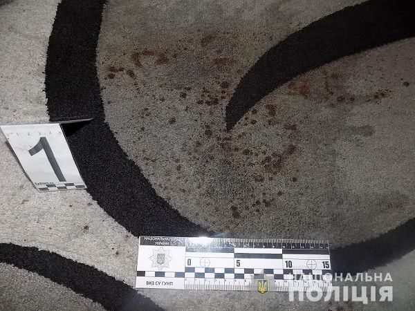 Жительница Одесской области выпила лишнего, приревновала своего мужа и пырнула его ножом. Фото