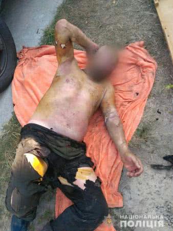 В Обуховском районе мужчина из-за ссоры с женой облился бензином и поджег себя