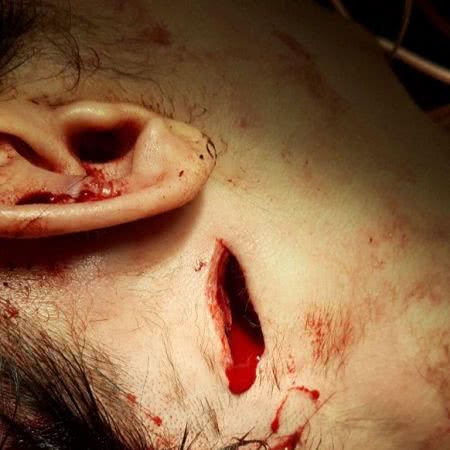 Суд отправил под домашний арест парня, который нанёс девушке 19 ударов ножом (ФОТО 18+)