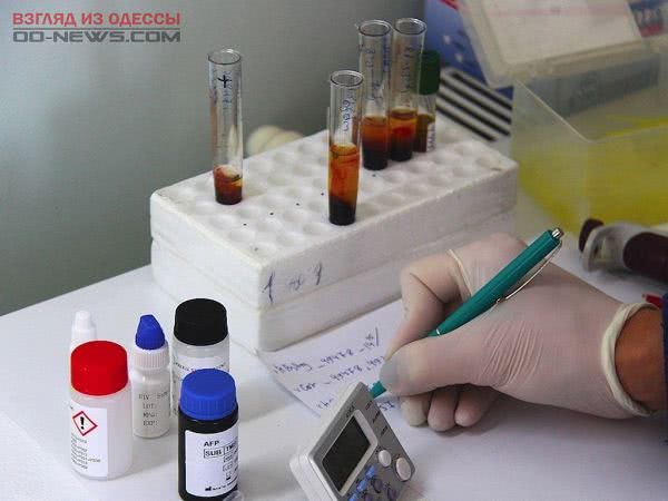Под Одессой одна из школ на карантине из-за болезни Боткина