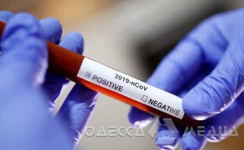 Сегодня Одесская область получит первую партию экспресс-тестов на коронавирус