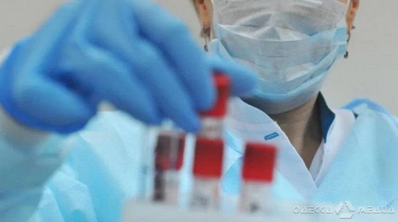 В Одессе у еще четверых пациентов положительный результат экспресс-тестов на коронавирус – мэрия