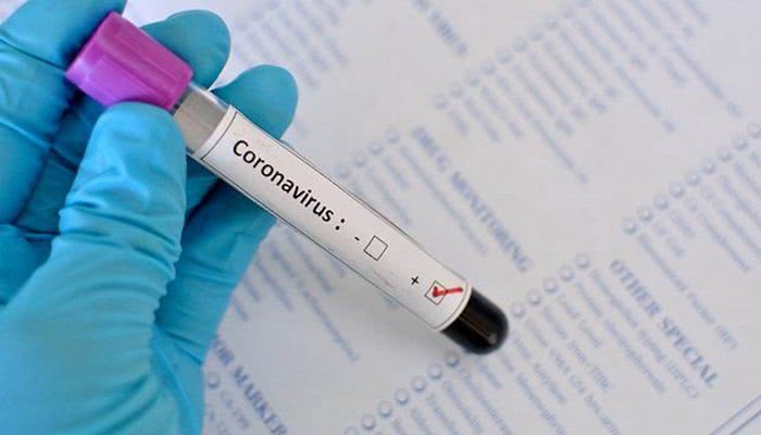 В Одессе нет тестов на коронавирус, — волонтеры