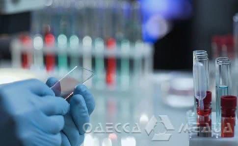 В Одесской области уже 169 случаев заражения коронавирусом: самому младшему пациенту – 9 месяцев