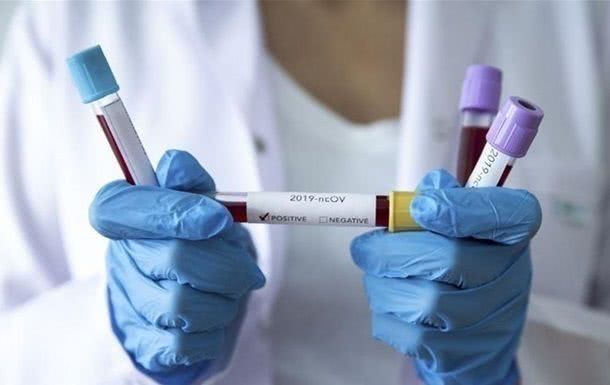В Одессе подтверждено 27 случаев заболевания COVID-19: подробности