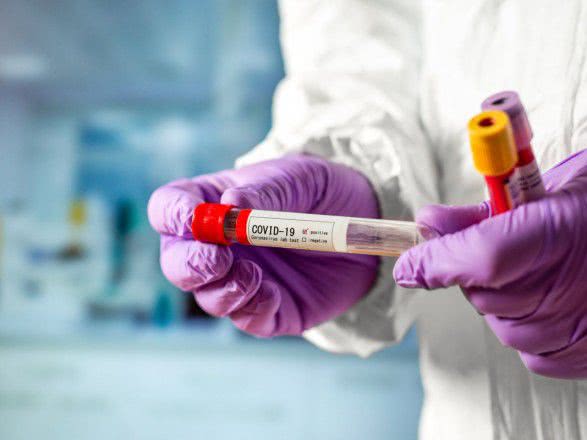 На Одещині ще 19 випадків коронавірусу: серед хворих медики та прикордонник