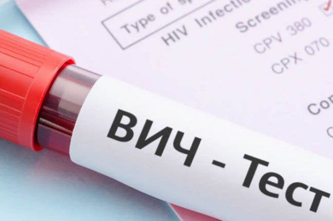 Жители Одессы и области могут бесплатно пройти тесты на гепатит и ВИЧ