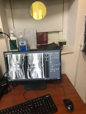 У Арцизской ЦРБ появился новый современный рентген-аппарат
