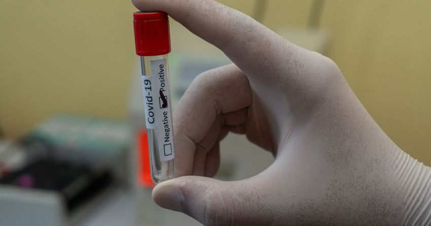 Коронавірус в Одеській області: виявили 202 інфікованих та розповіли, де їх найбільше