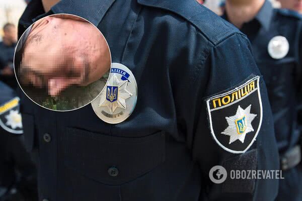Убийство девушки в одесской аптеке: подозреваемый нанес 36 ножевых ранений и похитил 70 тысяч грн