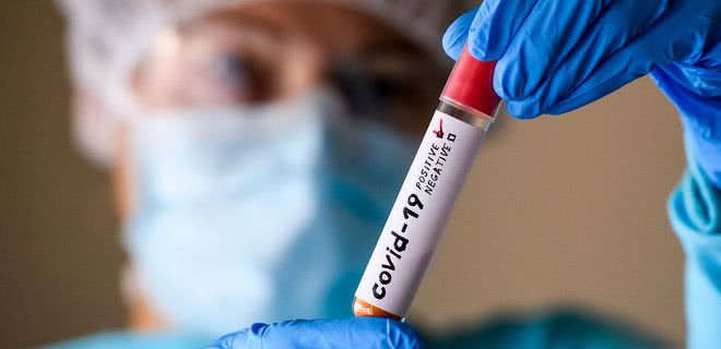 1015 осіб інфіковано COVID-19, та 20 хворих померло за добу по Одеській області
