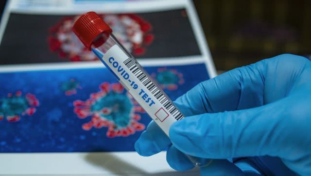 COVID-19: за добу по Одеській області інфіковано 729 осіб, та 20 хворих померло