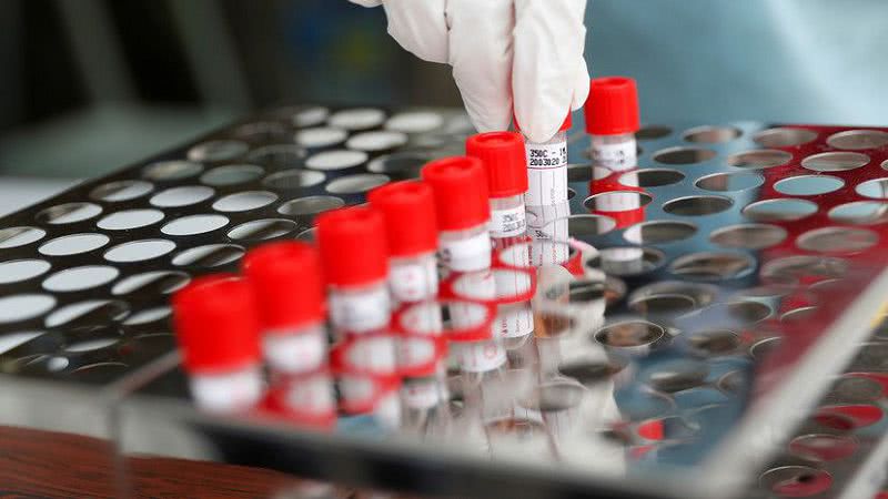 COVID-19: за добу по Одеській області інфіковано 453 особи, та 22 хворих померло