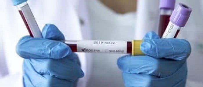 За минувшие сутки коронавирусом в Черноморске заболел 41 человек
