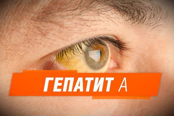 В Одесской области вспышка гепатита А