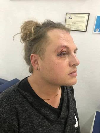 В Одессе совершено покушение на главного режиссера Оперного театра