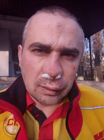 В Одесі співробітники охоронної фірми жорстоко побили ветерана АТО: подробиці скандалу
