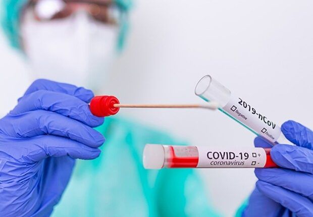 Статистика по COVID-19 в Одессе на 19 апреля