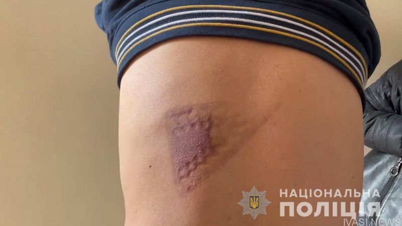 Ради квартир в Одессе жительница Николаева  организовала похищение и пытки двух граждан Греции (видео)