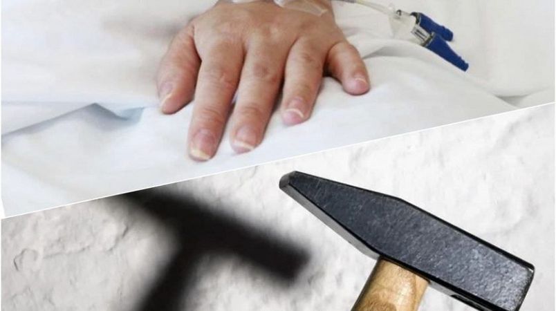 В Одеській області жителька Любашівської ОТГ через ревнощі молотком побила суперницю
