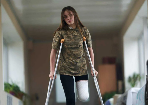 Одеситка Руслана Данилкіна втратила ногу на війні, але не здалася