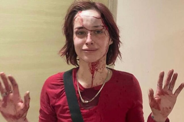 В Одесі працівник ТЦК побив дівчину милицею(фото)