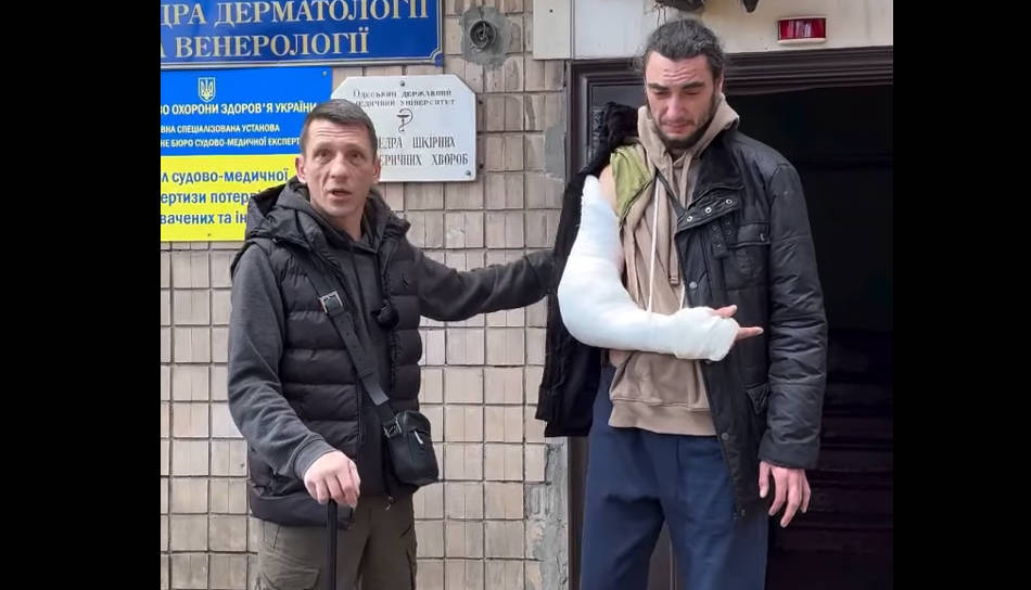 Ветерану одесской 28-й бригады сломали руку в результате силовой «бусификации»