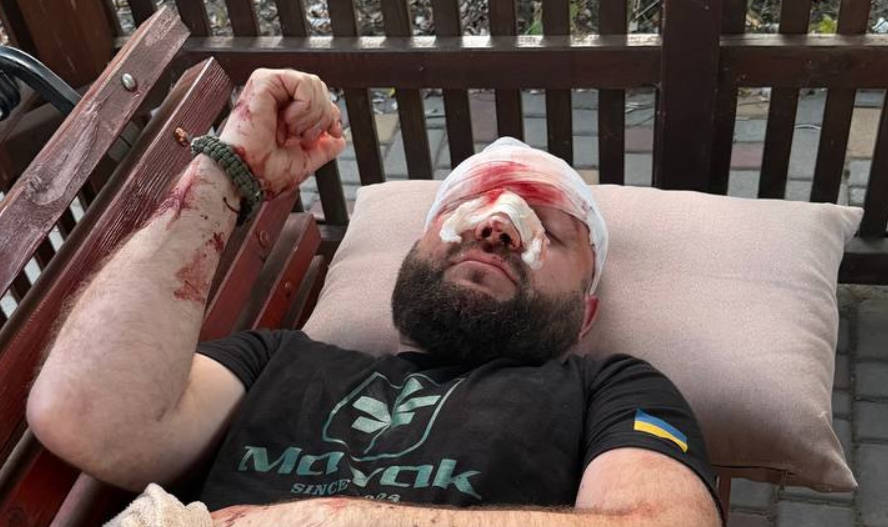В Затоке любитель российской музыки жестоко избил ветерана из-за замечания