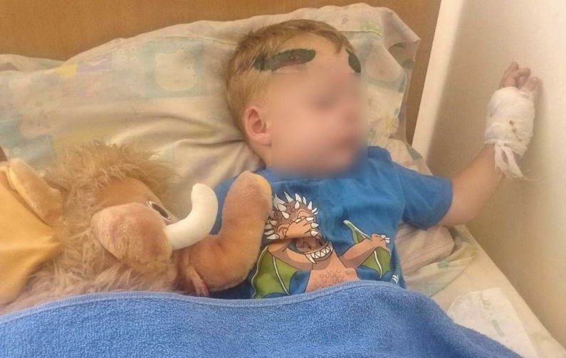 Водитель группы оповещения ТЦК в Одесской области наехал на 2,5-летнего ребенка во время задержания отца